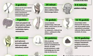 Grafika przedstawia etapy rozkładu ciała po śmierci, od pierwszych minut do miesięcy. Sekcja zwłok jest tu ukazana w sposób naukowy.